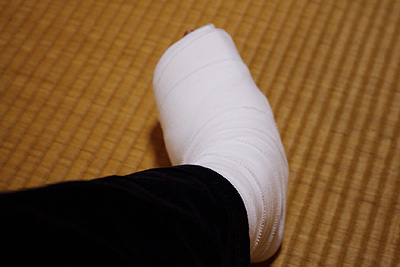 足の怪我